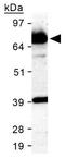 Scavenger Receptor Class B Member 1 antibody, GTX20396, GeneTex, Western Blot image 