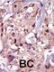 Tyrosine-protein kinase Tec antibody, abx033645, Abbexa, Immunohistochemistry frozen image 