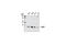 E3 ubiquitin-protein ligase CHIP antibody, 2080S, Cell Signaling Technology, Western Blot image 