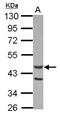 Actin Like 7A antibody, NBP2-15270, Novus Biologicals, Western Blot image 