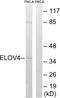 Elongation of very long chain fatty acids protein 4 antibody, A30673, Boster Biological Technology, Western Blot image 