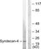 Syndecan 4 antibody, GTX87212, GeneTex, Western Blot image 
