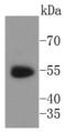 WT1 Transcription Factor antibody, A00199, Boster Biological Technology, Western Blot image 