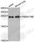 Transmembrane Protein 176B antibody, A3422, ABclonal Technology, Western Blot image 