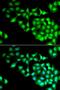 RNA Guanylyltransferase And 5'-Phosphatase antibody, LS-C335668, Lifespan Biosciences, Immunofluorescence image 