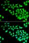 GTase antibody, LS-C335668, Lifespan Biosciences, Immunofluorescence image 