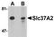 Solute Carrier Family 37 Member 2 antibody, TA306942, Origene, Western Blot image 