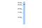 Adenosine Deaminase Domain Containing 2 antibody, GTX47217, GeneTex, Western Blot image 