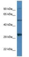 Sarcoglycan Delta antibody, NBP1-74201, Novus Biologicals, Western Blot image 