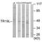 RELT TNF Receptor antibody, PA5-49868, Invitrogen Antibodies, Western Blot image 