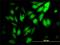 WD Repeat Domain 5 antibody, H00011091-M01, Novus Biologicals, Immunofluorescence image 