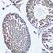 Farnesyl-Diphosphate Farnesyltransferase 1 antibody, GTX53976, GeneTex, Immunohistochemistry paraffin image 