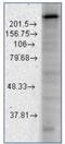 Calcium Voltage-Gated Channel Subunit Alpha1 H antibody, NBP1-22444, Novus Biologicals, Western Blot image 