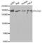 Phospholipase C Gamma 2 antibody, MBS126378, MyBioSource, Western Blot image 