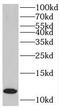 TGFB1-Induced Anti-Apoptotic Factor 1 antibody, FNab08686, FineTest, Western Blot image 