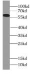 Calicin antibody, FNab01201, FineTest, Western Blot image 