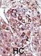 Diacylglycerol Kinase Zeta antibody, abx033845, Abbexa, Immunocytochemistry image 