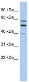 Transmembrane And Coiled-Coil Domain Family 1 antibody, TA335901, Origene, Western Blot image 