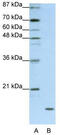 Apolipoprotein O antibody, TA343926, Origene, Western Blot image 