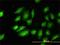 Tropomyosin 4 antibody, H00007171-M01, Novus Biologicals, Immunocytochemistry image 