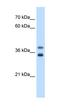 Glycerophosphodiester Phosphodiesterase 1 antibody, orb325331, Biorbyt, Western Blot image 
