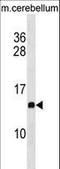 Prefoldin Subunit 2 antibody, LS-C158044, Lifespan Biosciences, Western Blot image 