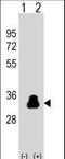 Kallikrein Related Peptidase 4 antibody, LS-C100092, Lifespan Biosciences, Western Blot image 