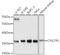 Cysteinyl Leukotriene Receptor 1 antibody, LS-C746795, Lifespan Biosciences, Western Blot image 