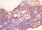 Tumor Associated Calcium Signal Transducer 2 antibody, orb11520, Biorbyt, Immunohistochemistry paraffin image 