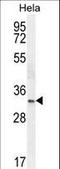 NK2 Homeobox 1 antibody, LS-B10666, Lifespan Biosciences, Western Blot image 