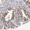Zinc Finger Protein 76 antibody, NBP1-85324, Novus Biologicals, Immunohistochemistry paraffin image 