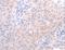 Anti-Mullerian Hormone antibody, LS-C405870, Lifespan Biosciences, Immunohistochemistry paraffin image 