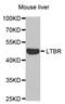 Lymphotoxin Beta Receptor antibody, LS-B13386, Lifespan Biosciences, Western Blot image 