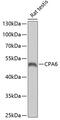 Carboxypeptidase A6 antibody, GTX32536, GeneTex, Western Blot image 