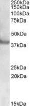 Receptor Associated Protein Of The Synapse antibody, MBS421993, MyBioSource, Western Blot image 