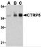 C1q And TNF Related 5 antibody, 3571, ProSci, Western Blot image 