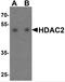 Histone Deacetylase 2 antibody, TA349073, Origene, Western Blot image 