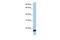 ADP Ribosylation Factor 6 antibody, PA5-44191, Invitrogen Antibodies, Western Blot image 