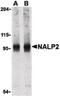 NACHT, LRR and PYD domains-containing protein 2 antibody, LS-B529, Lifespan Biosciences, Western Blot image 