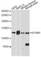 EPH Receptor B6 antibody, A14728, ABclonal Technology, Western Blot image 