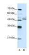 Zinc Finger Protein 296 antibody, orb324821, Biorbyt, Western Blot image 