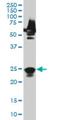 RAB33A, Member RAS Oncogene Family antibody, H00009363-M04, Novus Biologicals, Western Blot image 