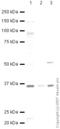 Presenilin Associated Rhomboid Like antibody, ab45231, Abcam, Western Blot image 