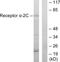 Adrenoceptor Alpha 2C antibody, LS-B9139, Lifespan Biosciences, Western Blot image 