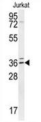 Tubulin Polyglutamylase Complex Subunit 2 antibody, AP54342PU-N, Origene, Western Blot image 