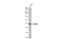 Matrix Metallopeptidase 1 antibody, GTX100534, GeneTex, Western Blot image 