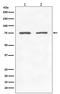 Glycyl-TRNA Synthetase antibody, M04618, Boster Biological Technology, Western Blot image 