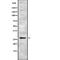 Insulin Like Growth Factor Binding Protein 4 antibody, abx216172, Abbexa, Western Blot image 