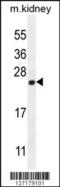 Calmodulin Like 4 antibody, 55-105, ProSci, Western Blot image 