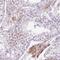 Zinc Finger Protein 35 antibody, PA5-63014, Invitrogen Antibodies, Immunohistochemistry frozen image 